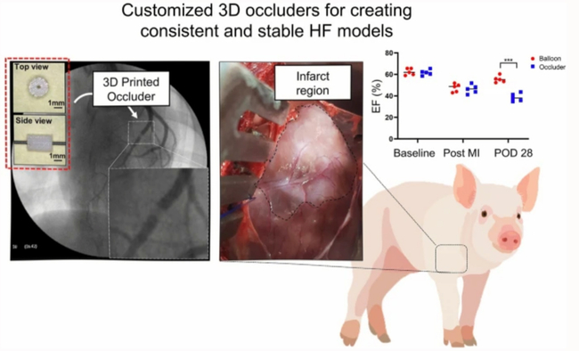 돼지 심근경색 모델 제작용 맞춤형 3D 프린팅 폐색기. 만성 심근경색 모델을 유발시킬 수 있는 획기적인 도구로 활용될 수 있다. 