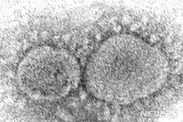 미국 질병통제예방센터(CDC)가 제공한 코로나19 바이러스 입자의 전자 현미경 이미지.(사진=뉴시스 제공)