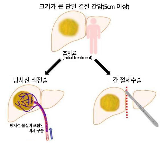 연구대상 구분 방법(사진=서울대병원 제공)