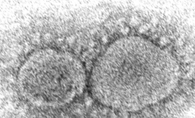 미국 질병통제예방센터(CDC)가 제공한 코로나19 바이러스 입자의 전자 현미경 이미지.