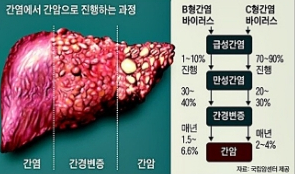 자료=민경윤저 ‘간염에서 간경변 간암에 이르기까지의 똑똑한 투병기’ p100