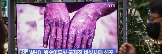 세계보건기구(WHO)가 세계 전역에서 발병한 원숭이두창에 대해 '국제적으로 우려되는 공중보건상 비상사태(PHEIC)'를 선언한 24일 오전 인천국제공항 1터미널 입국장에서 시민들이 TV를 통해 관련 뉴스를 시청하고 있다.