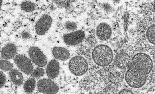 미국 질병통제예방센터(CDC)가 공개한 이 2003년 전자현미경 사진은 프레리도그(Prairie dog) 발병과 관련된 인간의 피부 표본에서 얻은 것으로, 성숙한 타원형의 원숭이두창 바이러스(왼쪽과)와 원모양의 미성숙한 바이러스(오른쪽)가 찍혀 있다. (사진=뉴시스 제공)
