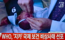 WHO, ‘지카 바이러스’ 국제 보건 비상사태 선포