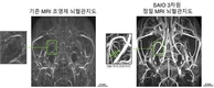 선명도 10배 높이는 MRI 조영제 개발…기초과학연구원·연세대 공동 개발